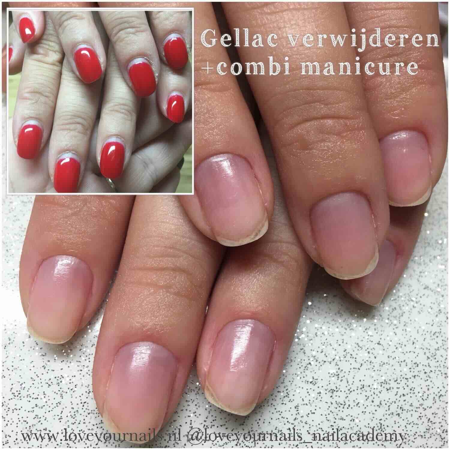 Gel, BIAB of gellak verwijderen met combi manicure